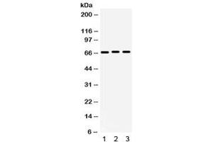 Western blot testing of human 1) 293, 2) A549 and 3) PANC cell lysate with KCNA5 antibody. (KCNA5 antibody)