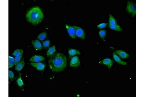 KIR2DS3 antibody  (AA 102-241)