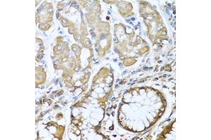 Immunohistochemistry of paraffin-embedded human stomach using NRG4 antibody (ABIN3016309, ABIN3016310, ABIN3016311 and ABIN6219713) at dilution of 1:100 (40x lens). (Neuregulin 4 antibody  (AA 1-115))
