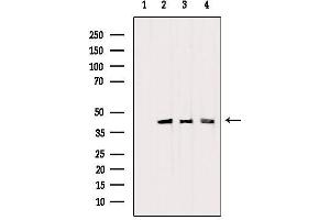 Western blot analysis of extracts from various samples, using PDHA1 Antibody. (PDHA1 antibody  (C-Term))