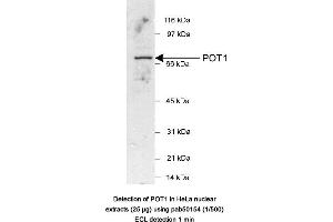 Image no. 1 for anti-Protection of Telomeres 1 (POT1) (AA 200-300) antibody (ABIN363463) (POT1 antibody  (AA 200-300))
