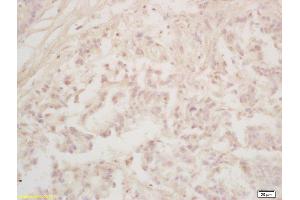 Immunohistochemistry (IHC) image for anti-Runt-Related Transcription Factor 3 (RUNX3) (AA 31-130) antibody (ABIN1714069)