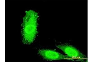 Immunofluorescence of monoclonal antibody to IRAK3 on HeLa cell. (IRAK3 antibody  (AA 497-596))