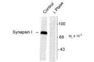 Image no. 1 for anti-Synapsin I (SYN1) (pSer603) antibody (ABIN227585) (SYN1 antibody  (pSer603))