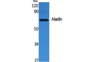 Western Blotting (WB) image for anti-Achalasia, Adrenocortical Insufficiency, Alacrimia (AAAS) (C-Term) antibody (ABIN3178076) (Adracalin antibody  (C-Term))