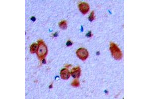 Immunohistochemical analysis of Ryanodine Receptor 2 (pS2808) staining in human brain formalin fixed paraffin embedded tissue section. (RYR2 antibody  (pSer2808))