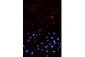 Immunofluorescence analysis of MCF-7 cells using Phospho-CDK1-T14 antibody (ABIN5969876). (CDK1 antibody  (pThr14))