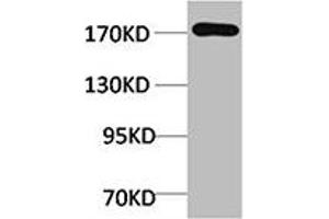 Western blot analysis of Rat Liver Tissue using EPG5 Polyclonal Antibody. (EPG5 antibody)