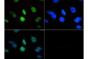 Immunofluorescence of Rabbit Anti-Histone H3 [Trimethyl Lys18] Antibody. (Histone 3 antibody  (3meLys18))