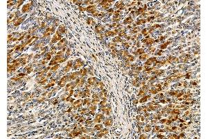 ABIN6263527 and ABIN6279597 at 1/100 staining rat stomach tissue by IHC-P. (NBPF6 antibody  (C-Term))