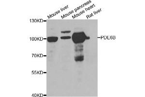 Western blot analysis of extracts of various cell lines, using PDE6B antibody. (PDE6B antibody)