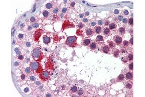 Anti-MTL5 antibody IHC of human testis. (MTL5 antibody  (AA 51-100))