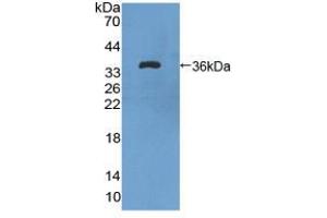 Figure. (FLT1 antibody  (AA 18-308))