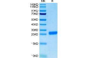 Cynomolgus NGAL on Tris-Bis PAGE under reduced condition. (Lipocalin 2 Protein (LCN2) (AA 21-198) (His tag))