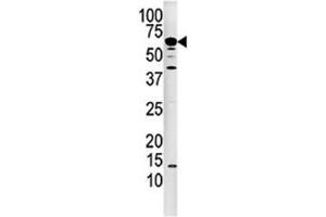 Western blot analysis of Calcineurin antibody and mouse kidney tissue lysate. (CAN antibody  (AA 21-51))
