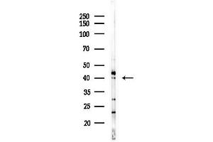 anti-Testis Specific Serine Kinase 4 (TSSK4) (Internal Region) antibody