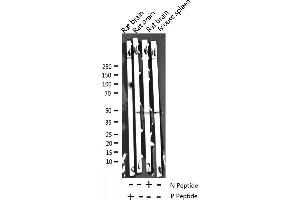 Western blot analysis of Phospho-Caspase 9 (Thr125) expression in various lysates (Caspase 9 antibody  (pThr125))