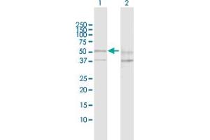 Western Blot analysis of SESN2 expression in transfected 293T cell line by SESN2 MaxPab polyclonal antibody. (Sestrin 2 antibody  (AA 1-480))