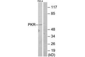 Western blot analysis of extracts from HeLa, using PKR (Ab-446) Antibody. (EIF2AK2 antibody  (AA 413-462))