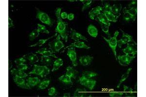 Immunofluorescence of monoclonal antibody to ACBD3 on HeLa cell. (ACBD3 antibody  (AA 73-171))