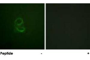 Immunofluorescence analysis of A-549 cells, using IL4R polyclonal antibody . (IL4 Receptor antibody)