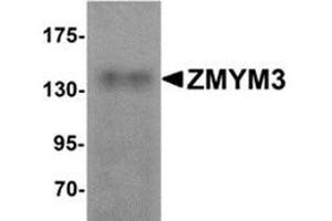 Western blot analysis of ZMYM3 in human brain tissue lysate with ZMYM3 antibody at 1 μg/ml. (ZMYM3 antibody  (N-Term))
