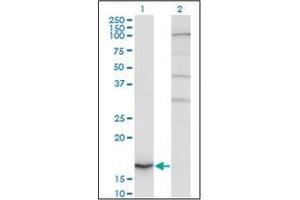 Western Blotting (WB) image for anti-Cytochrome b5 (CYTB5) (AA 1-135) antibody (ABIN951799) (Cytochrome b5 (CYTB5) (AA 1-135) antibody)