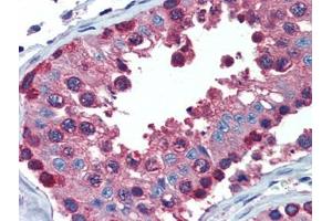 Testis, Human: Formalin-Fixed, Paraffin-Embedded (FFPE) (PDIA4 antibody  (AA 623-638))