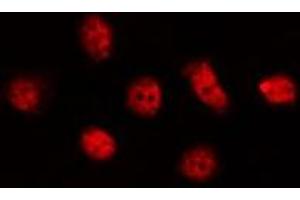 ABIN6278559 staining LOVO by IF/ICC. (CLK4 antibody  (Internal Region))