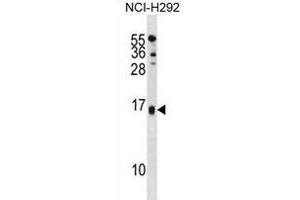 SELM Antibody (C-term) (ABIN1881785 and ABIN2839007) western blot analysis in NCI- cell line lysates (35 μg/lane). (SELM antibody  (C-Term))