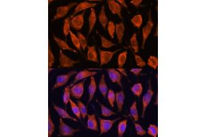 Immunofluorescence (IF) image for anti-Tumor Necrosis Factor, alpha-Induced Protein 8-Like 2 (TNFAIP8L2) (AA 1-184) antibody (ABIN6149298)