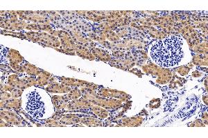 Detection of MAPK14 in Porcine Kidney Tissue using Polyclonal Antibody to Mitogen Activated Protein Kinase 14 (MAPK14) (MAPK14 antibody  (AA 19-279))