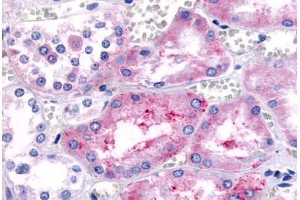 PTGER1 antibody  (Cytoplasmic Domain)