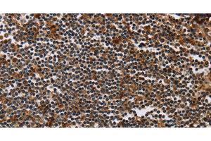 Immunohistochemistry of paraffin-embedded Human tonsil using MAGEA3 Polyclonal Antibody at dilution of 1:50 (MAGEA3 antibody)