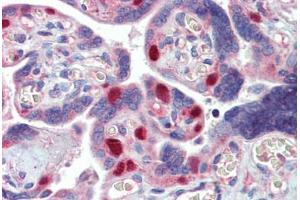 Placenta, Human: Formalin-Fixed, Paraffin-Embedded (FFPE) (MCL-1 antibody)