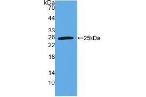 Detection of Recombinant VEGI, Human using Polyclonal Antibody to TNF Like Ligand 1A (TL1A) (TNF Like Ligand 1A (AA 67-251) antibody)