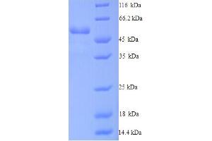 Dynactin 4 Protein (DCTN4) (AA 2-460) (His tag)