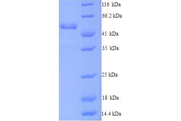 Dynactin 4 Protein (DCTN4) (AA 2-460) (His tag)