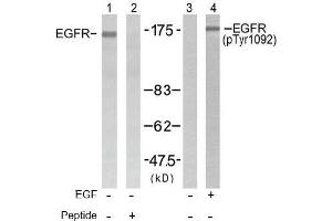 Image no. 1 for anti-Epidermal Growth Factor Receptor (EGFR) (pTyr1092) antibody (ABIN196761) (EGFR antibody  (pTyr1092))