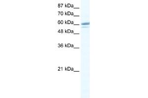WB Suggested Anti-ZNF232 Antibody Titration:  0. (ZNF232 antibody  (Middle Region))