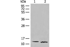 Western blot analysis of Human fetal brain tissue and Mouse thymus tissue lysates using GALP Polyclonal Antibody at dilution of 1:500 (GALP antibody)