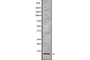 Western blot analysis of RPAB4 using Jurkat whole cell lysates (POLR2K antibody  (Internal Region))