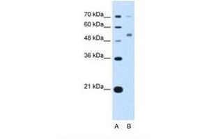 Image no. 2 for anti-Cerebellar Degeneration-Related Protein 2, 62kDa (CDR2) (N-Term) antibody (ABIN321833) (CDR2 antibody  (N-Term))