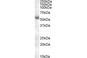 Image no. 1 for anti-Transmembrane Protease, serine 2 (TMPRSS2) (AA 518-529) antibody (ABIN342990) (TMPRSS2 antibody  (AA 518-529))