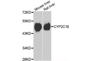 Western blot analysis of extracts of mouse liver and rat liver cell lines, using CYP2C18 antibody.