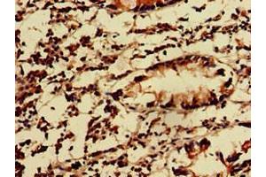 Immunohistochemistry of paraffin-embedded human appendix tissue using ABIN7157550 at dilution of 1:100 (KIDINS220 antibody  (AA 1077-1370))