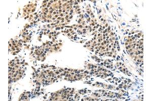 Immunohistochemistry (IHC) image for anti-Melanoma Antigen Family A, 6 (MAGEA6) antibody (ABIN5957147)
