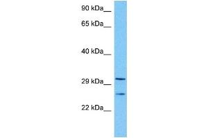 Host:  Mouse  Target Name:  TAL1  Sample Tissue:  Mouse Kidney  Antibody Dilution:  1ug/ml (TAL1 antibody  (Middle Region))