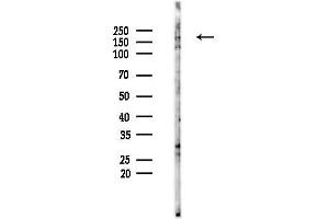 Western blot analysis of lysates from HUVEC cells(starvation 24h treatment), using UGGT1 Antibody at 1/1000 dilution.
