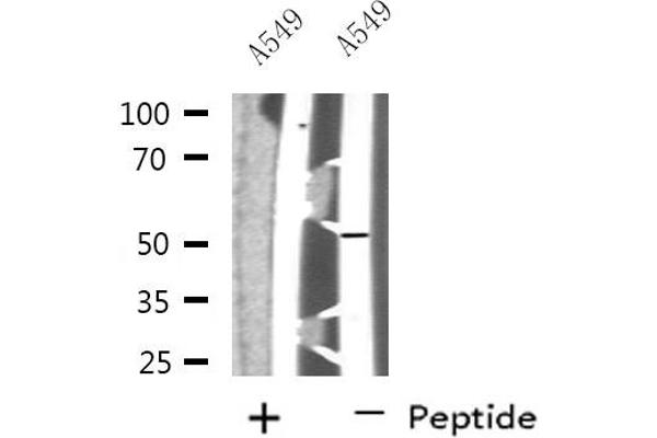 NARFL antibody  (Internal Region)